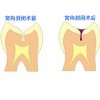 陽泉銷量好的基礎(chǔ)牙科中心【薦】，微創(chuàng)拔牙